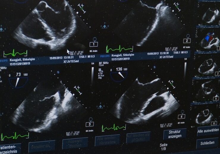 Samsung Continues to Make Significant Investment in its Ultrasound Business in North America