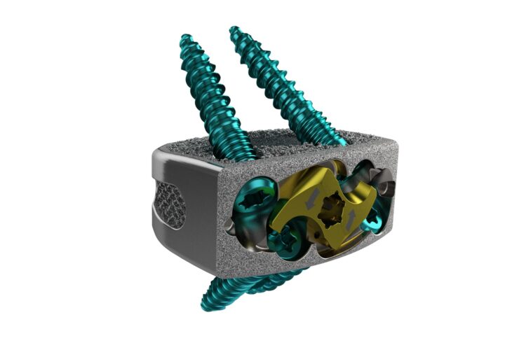 ChoiceSpine Announces Line Extension of their Harrier Stand-Alone Anterior Lumbar Interbody Fusion System