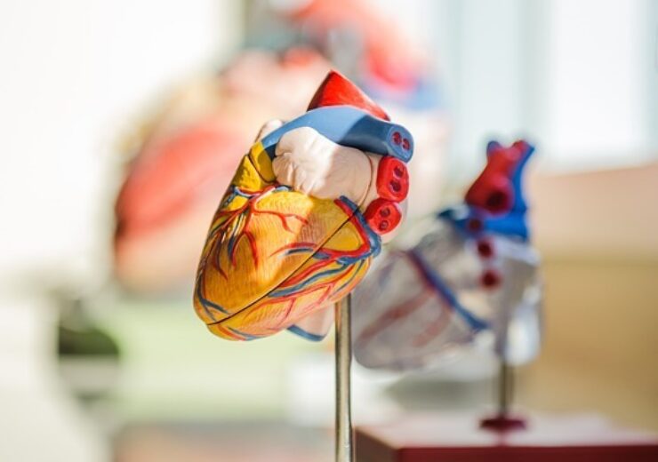 Tempus to evaluate AI-enabled predictive tests in cardiology