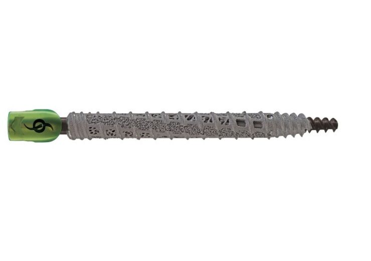 SI-BONE secures FDA nod for expanded rod compatibility with IFuse Bedrock Granite