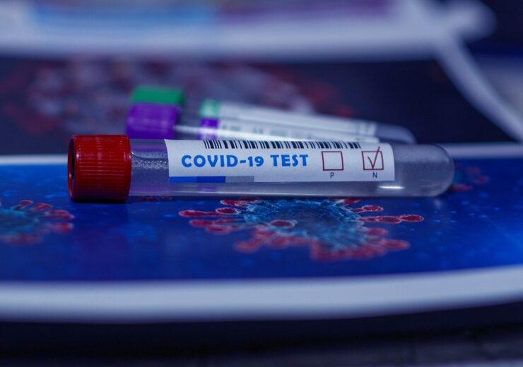 MHUA’s Jiangsu Huadong, Getein partner for Covid-19 test kits and IVDs in China