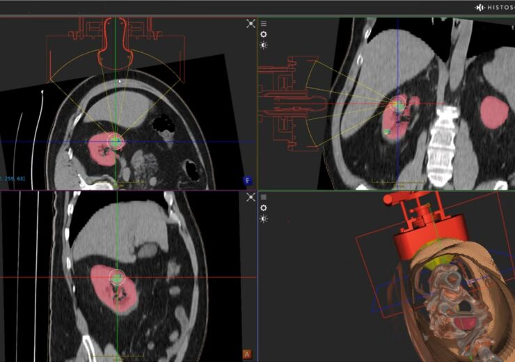 Kidney-Simulation-image-for-PR-v3