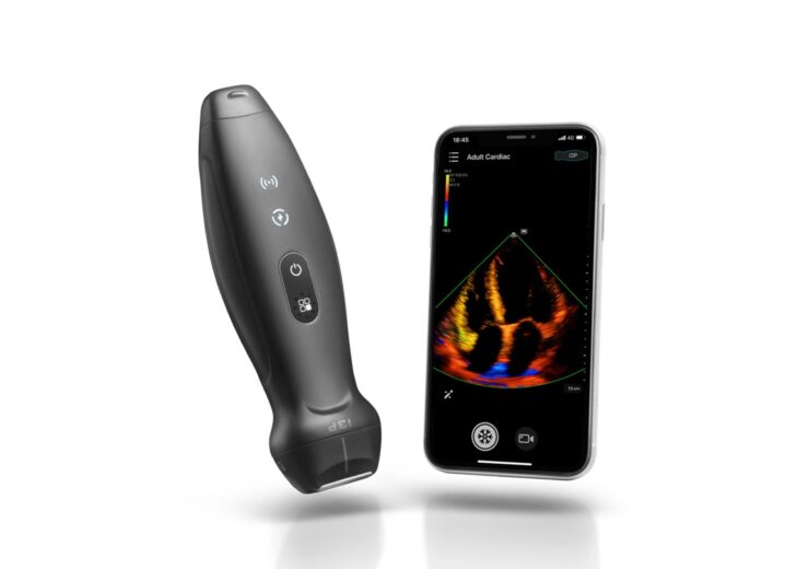 Mindray rolls out first wireless handheld ultrasound system, TE Air