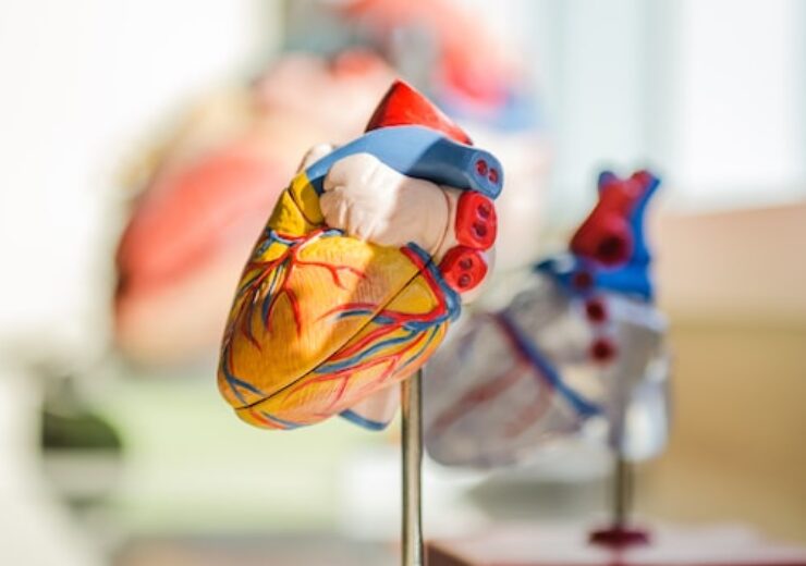 Abbott to acquire Cardiovascular Systems (CSI) for $890m