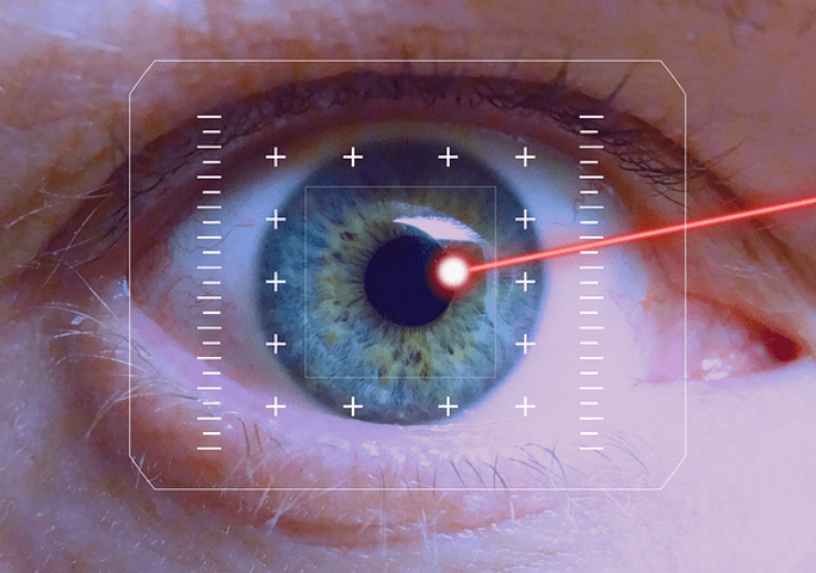 Alcon Announces Settlement of Litigation Related to Femtosecond Laser Assisted Cataract Surgery Devices