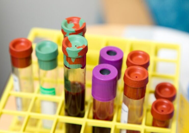 Oxford BioDynamics demonstrates PSE test’s potential in prostate cancer screening