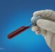 Guardant seeks FDA premarket approval for Shield test to detect colorectal cancer