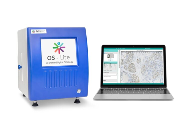 OptraSCAN launches OnDemand Digital Pathology