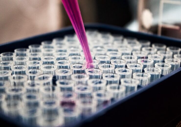 Todos to license Acumen Diagnostics’ PCR-based sepsis diagnostic test