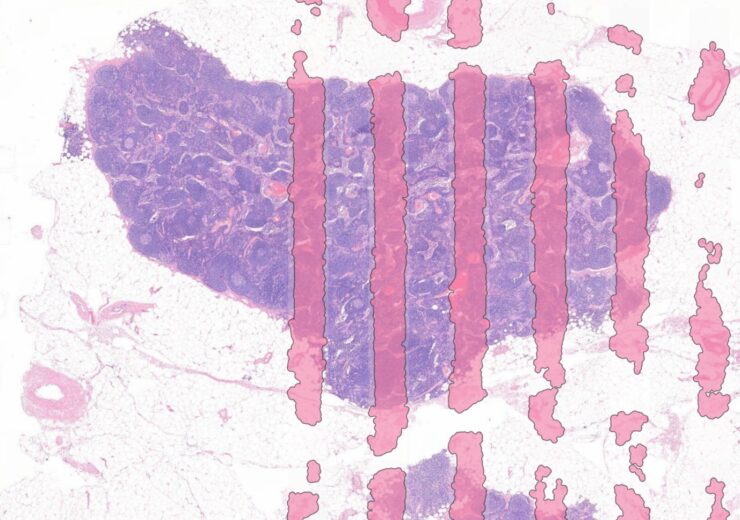 Aiosyn introduces AI-driven AiosynQC to enhance digital pathology workflow