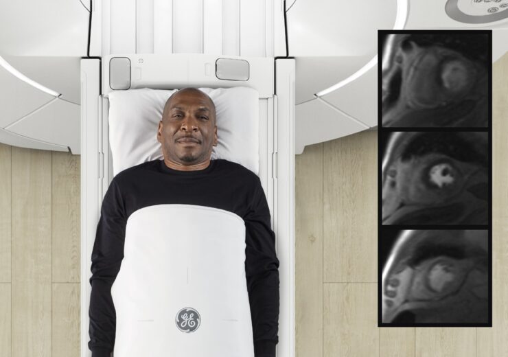 GE HealthCare introduces macrocyclic MRI agent Pixxoscan
