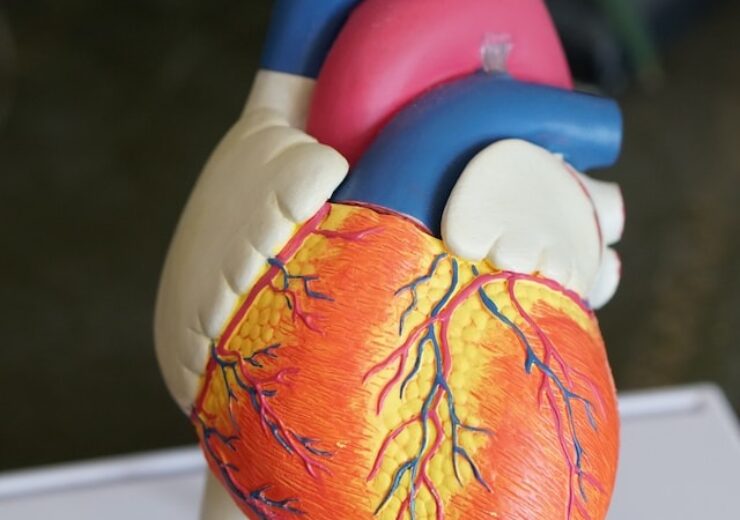 HeartFlow rakes in $215m for AI-based precision heart care products