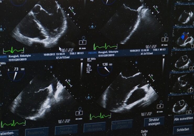 GE HealthCare expands bkActiv intraoperative ultrasound imaging system