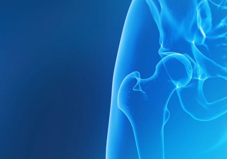 Formus Labs secures FDA approval for hip replacement pre-op planning solution