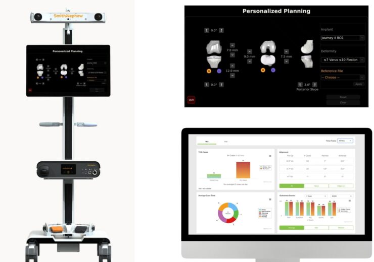 Smith+Nephew launches AI-based planning software and data visualisation platform