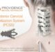 Providence Medical Technology Announces Completion of Enrollment in the FUSE Clinical Study for High-Risk Cervical Fusion Patients