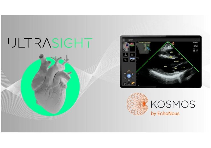 UltraSight, EchoNous partner to enhance access to cardiac ultrasound