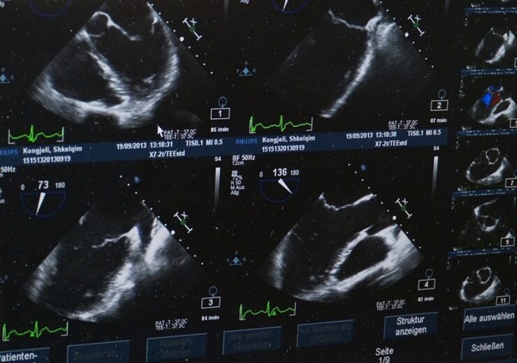 Exo and Sana Kliniken AG Partner to Bring Smart Ultrasound to Germany