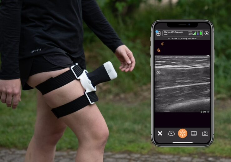 Clarius, Usono to provide integrated wireless and wearable ultrasound imaging solution