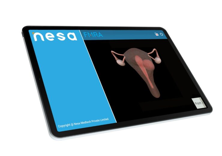 Nesa Medtech RECEIVES US FDA clearance for its FIBROID MAPPING REVIEWER application