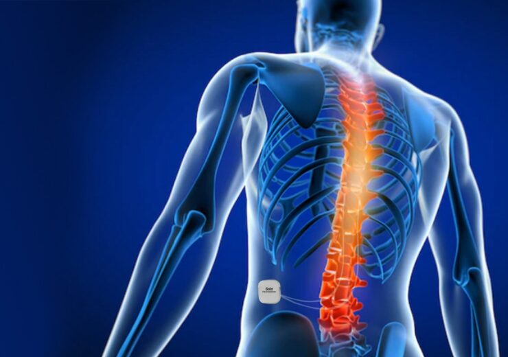 Soin Neuroscience Tests Very Low Frequency Spinal Cord Stimulation in Humans