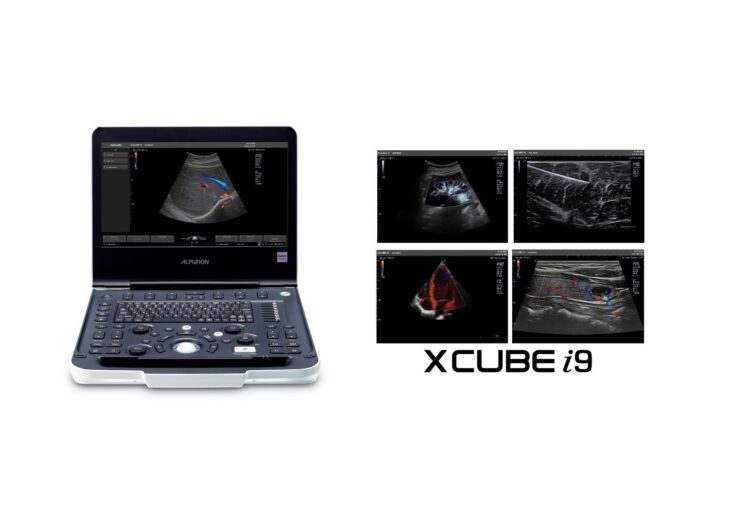 Alpinion rolls out new portable ultrasound diagnostic device, X-CUBE i9