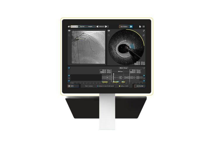 SpectraWAVE Secures 510(k) Clearance to Add Saline Imaging and Expanded Artificial Intelligence Features to the HyperVue Imaging System