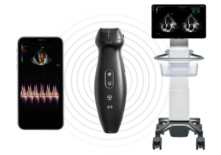 Mindray Introduces Groundbreaking 2-in-1 Handheld Ultrasound Device