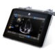 GE HealthCare enhances Venue ultrasound systems with Caption Guidance software