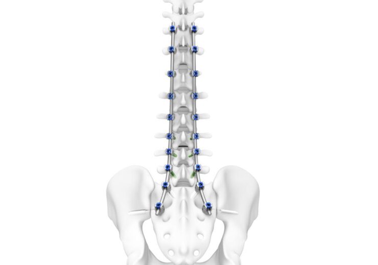 DePuy Synthes secures FDA nod for TriALTIS spine system and navigation instruments