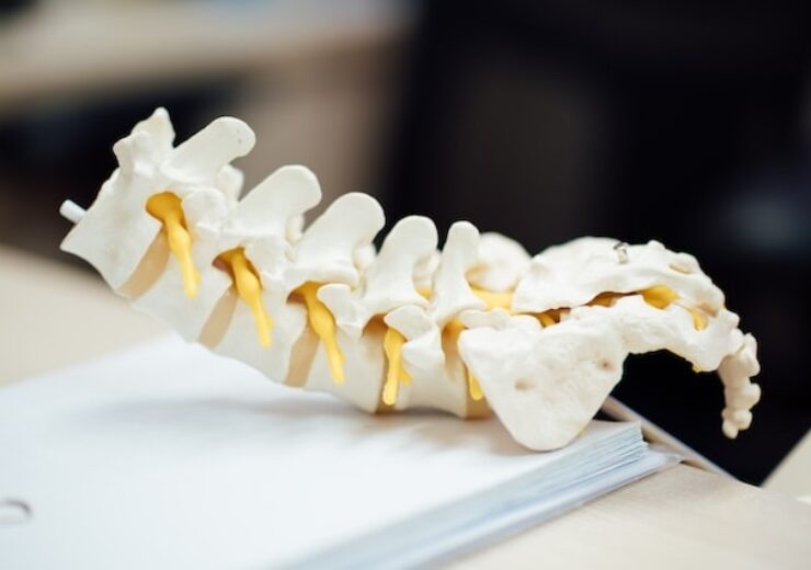 Vy Spine Announces FDA Clearance for its ClariVy OsteoVy PEKK Cervical IBF