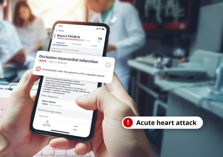PMcardio Is The First Certified Solution To Outperform Doctors in Heart Attack Detection With AI
