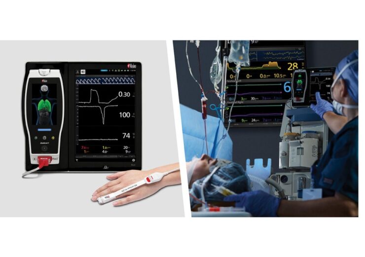 New Study Finds Significant Correlation Between Masimo ORi and Arterial Partial Pressure of Oxygen During One-Lung Ventilation