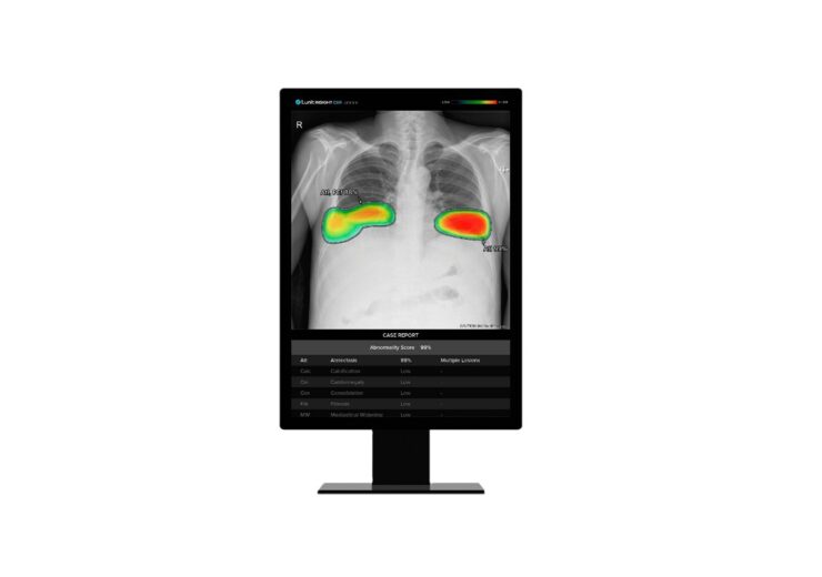 Lunit to power Samsung’s X-ray devices for enhanced chest screening