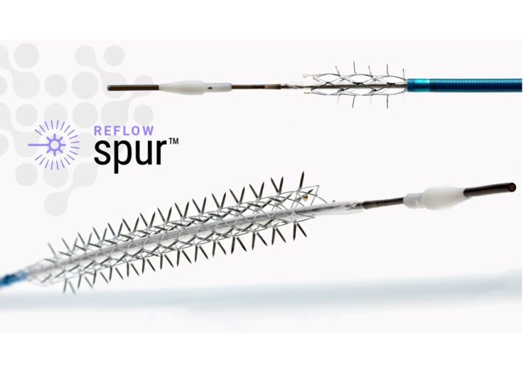 Bare Temporary Spur Stent System