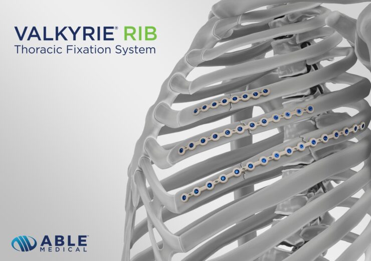 Able Medical’s Valkyrie RIB System secures FDA clearance for thoracic repair