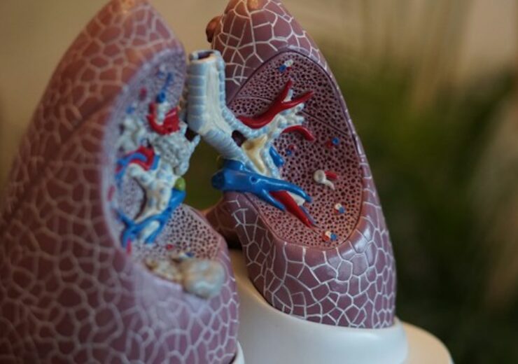Pulmonx initiates CONVERT II study of AeriSeal System in COPD patients