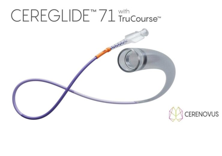 Cerenovus rolls out Cereglide 71 catheter with TruCourse technology