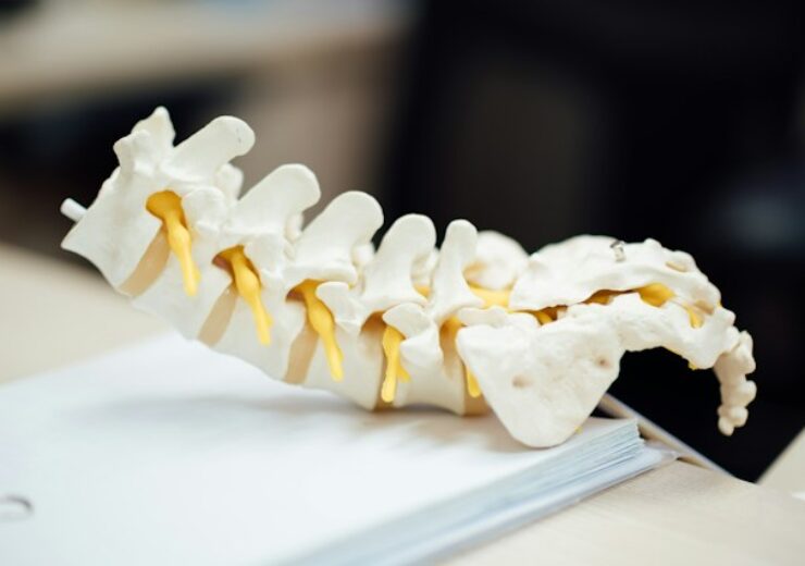 Aurora Spine secures second patent for DEXA Technology in US