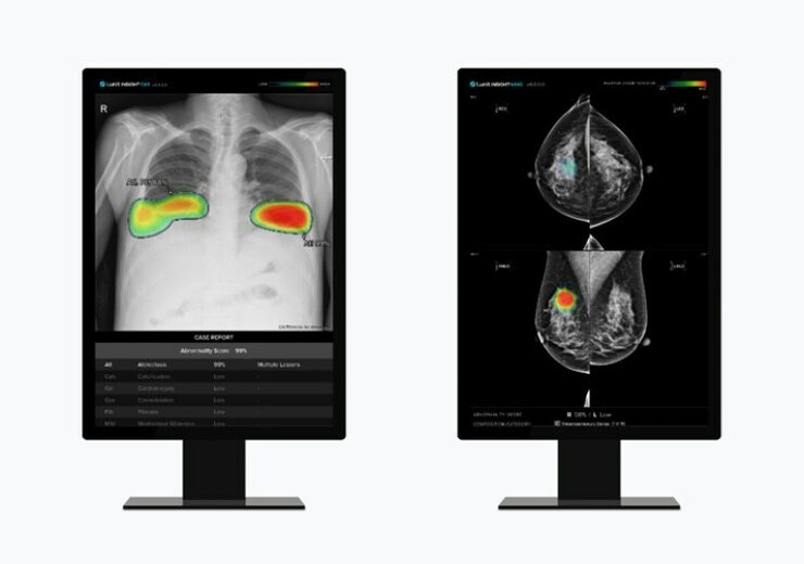 Lunit expands AI medical imaging solutions in Taiwan and Singapore