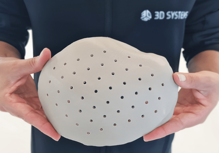3D Systems secures FDA approval for VSP PEEK Cranial Implant