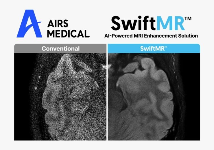 AIRS Medical accelerates global expansion with MRI AI solution SwiftMR supply contracts in Germany and the UK