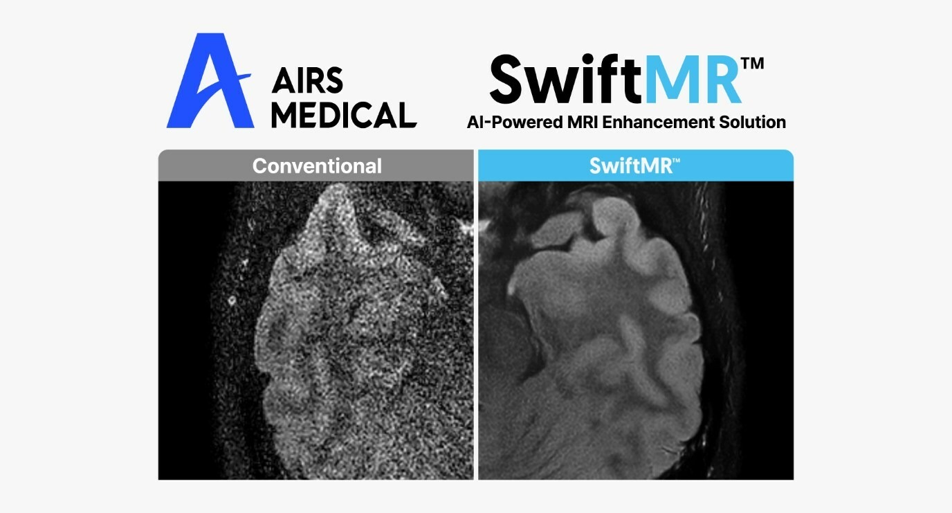 AIRS Medical accelerates global expansion with MRI AI solution SwiftMR supply contracts in Germany and the UK. (Credit: PRNewswire/AIRS Medical Inc.)