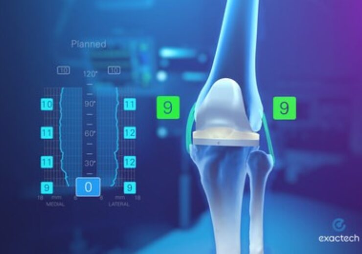 Exactech Strengthens Position as Soft Tissue Balancing Technology Leader with New Patents