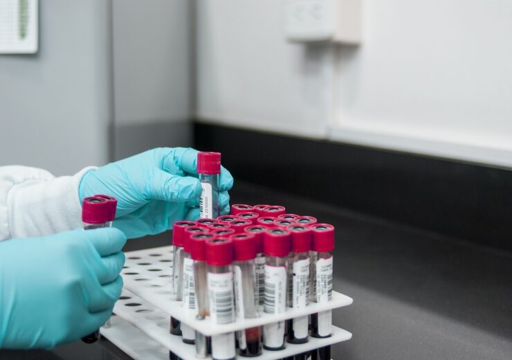 Labcorp rolls out new blood-based test to early detect neurodegenerative diseases