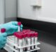 Labcorp rolls out new blood-based test to early detect neurodegenerative diseases