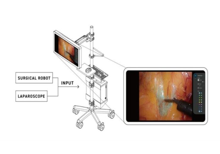 Anaut’s Eureka α surgical visualisation tool gets Japanese approval